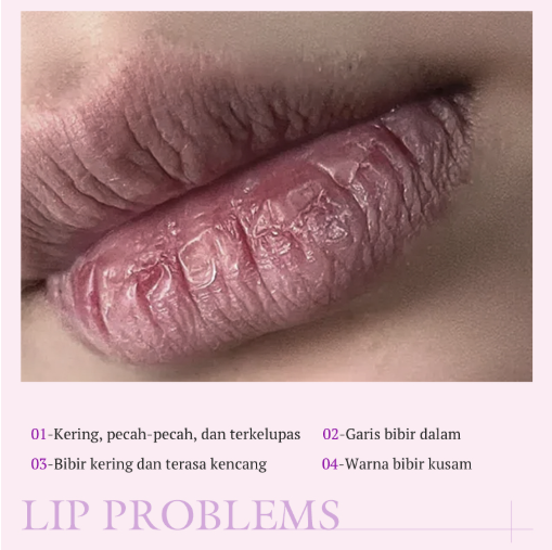 KORMESIC Strawberry Lip Balm 2,7 g
